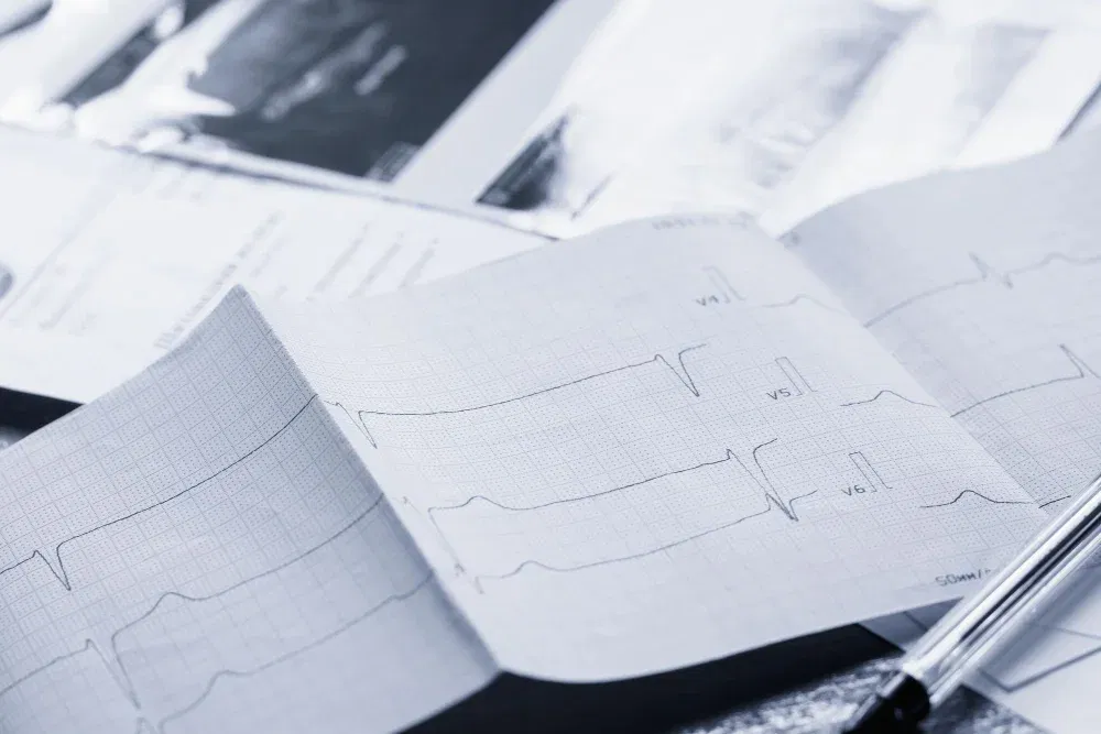 Kardiorespiratorische Polygraphie​ - Pneumologische Facharztpraxis Dr. Eisele in Koblenz